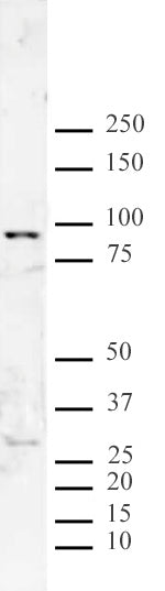 JMJD2F antibody (pAb) - MyBio Ireland - Active Motif