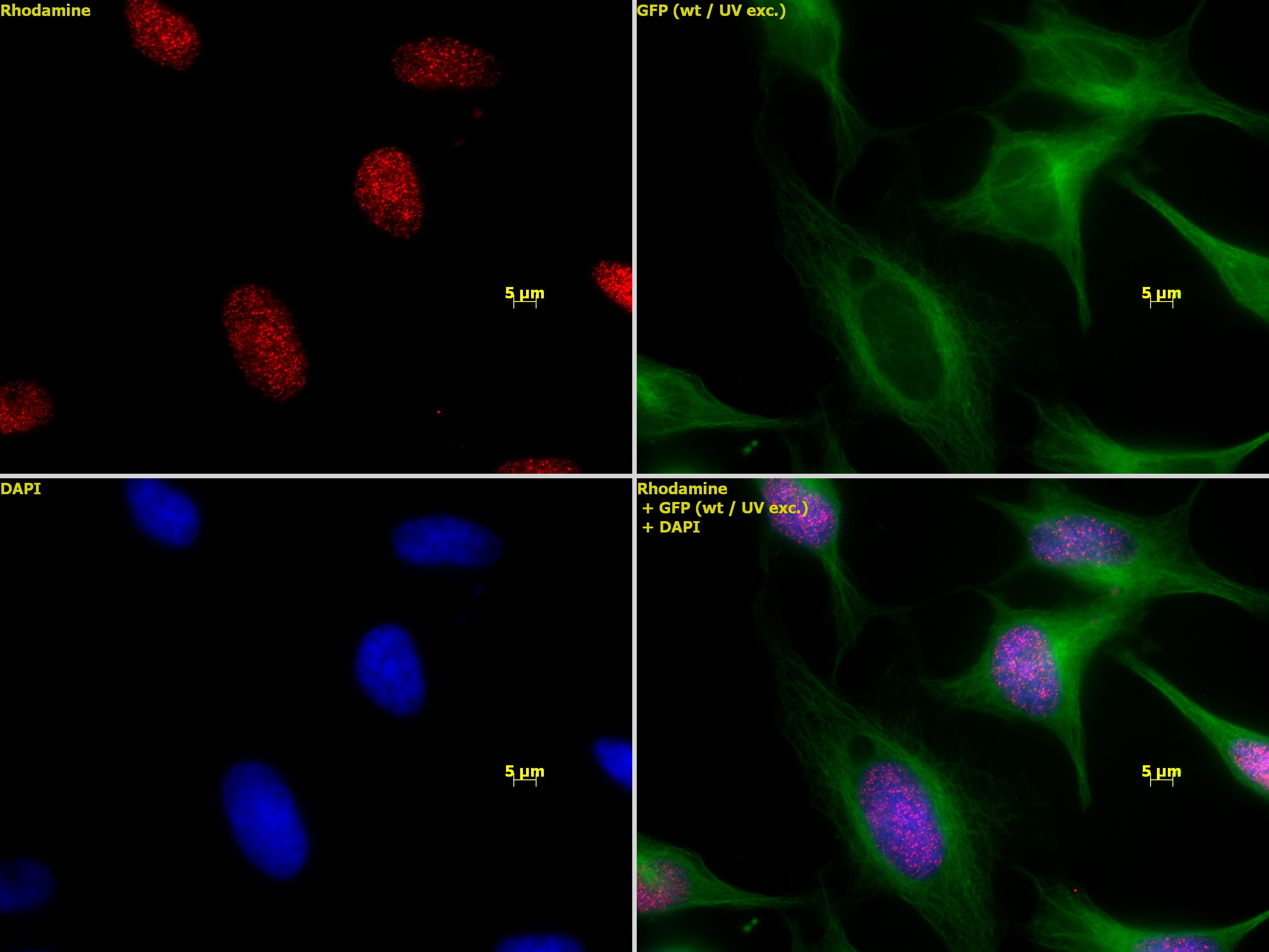 Histone H3K27me1 antibody (pAb) - MyBio Ireland - Active Motif