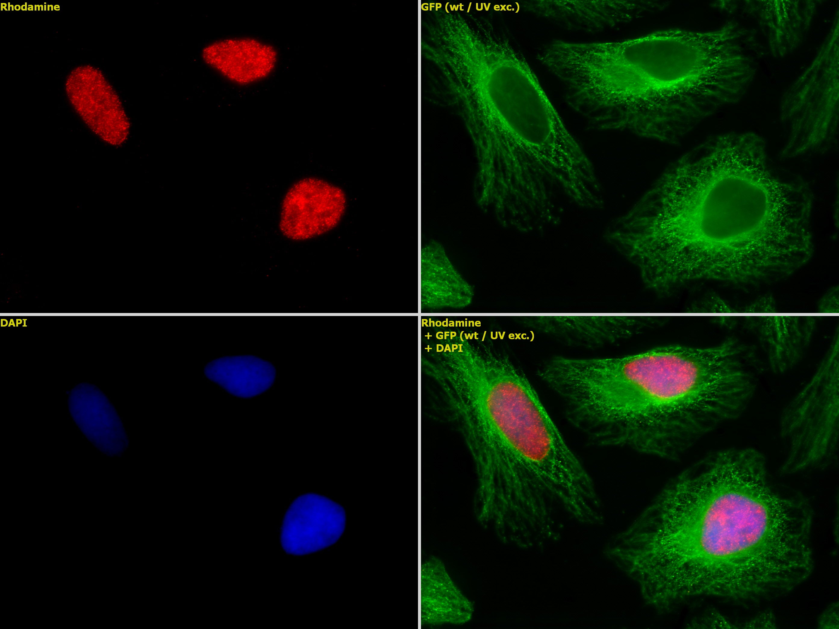 Histone H2BK46me2 antibody (pAb), sample - MyBio Ireland - Active Motif