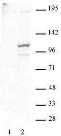 STAT2 phospho Tyr689 antibody (pAb) - MyBio Ireland - Active Motif