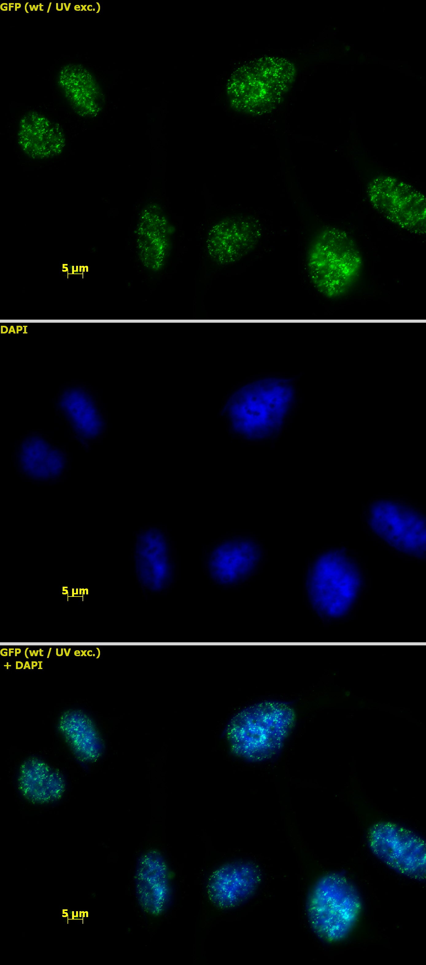 HMGA1 antibody (pAb) - MyBio Ireland - Active Motif