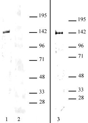 HDAC9 antibody (pAb), sample - MyBio Ireland - Active Motif