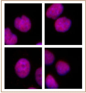 MMSET / WHSC1 antibody (mAb) - MyBio Ireland - Active Motif